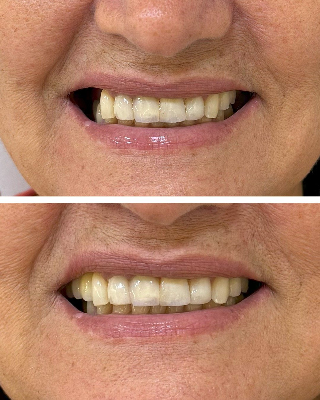 Antes e depois — Ortodontia · paciente real IEB